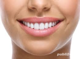 consultatie stomatologica + detartraj cu ultrasunete + periaj profesional