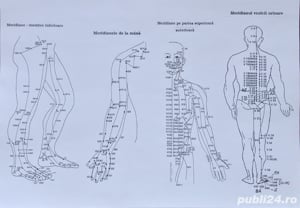 Diagnoză și tratament fără dureri care ameliorează starea generală de sănătate, prin Electropunctură - imagine 2