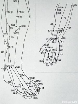 Diagnoză și tratament fără dureri care ameliorează starea generală de sănătate, prin Electropunctură - imagine 3