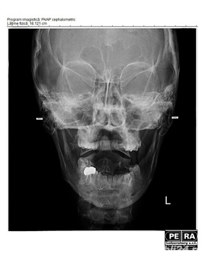 Radiografie de Sinusuri Anterioare ale Fetei Digitala (SAF) Str. Amman, nr. 20, sector 1, Bucuresti