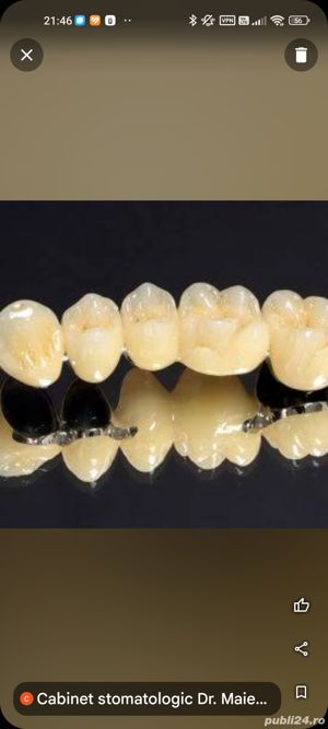 Servicii stomatologice de calitate la preturi accesibile.Cabinet în relație cu CAS. - imagine 6