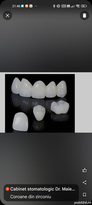 Servicii stomatologice de calitate la preturi accesibile.Cabinet în relație cu CAS. - imagine 5