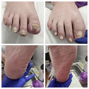 Pedichiura clasică si tratament cu parafină oradea - imagine 2