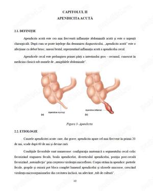 Îngrijirea pacientului cu Apendicită - imagine 3