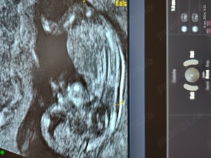 Ecograf doppler Voluson E8 Expert - imagine 7