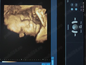 Ecograf doppler Voluson E8 Expert - imagine 6