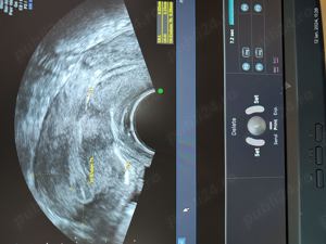 Ecograf doppler Voluson E8 Expert - imagine 4