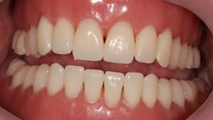 Cabinet Stomatologic Gratuit Compensat - imagine 5