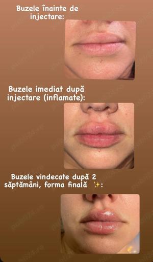 Servicii înfrumusețare  - imagine 2