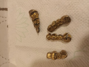 Coroane dentare din aliaj pretios  - imagine 2