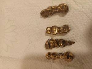 Coroane dentare din aliaj pretios  - imagine 4