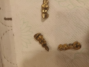 Coroane dentare din aliaj pretios  - imagine 5