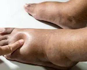 Drenaj Limfatic Manual in diverse afectiuni,la domiciliul pacientilor - imagine 4