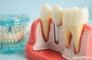 Angajez tehnician dentar