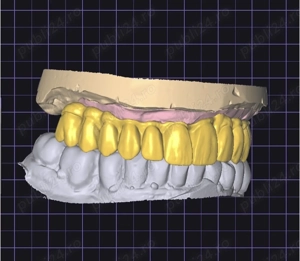 Colaborare pentru design exocad - imagine 2