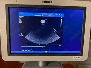 Vand ecograf Philips iE33 xMATRIX cu 3 sonde - imagine 5