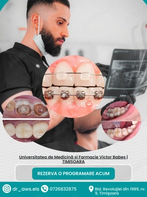 Preț redus pentru tratamentul ortodontic 