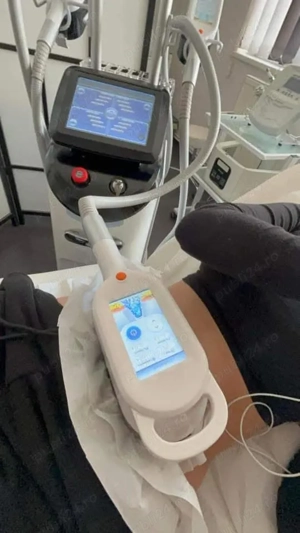 Criolipoliza,Cavitatie,Radiofrecventa,Lipolaser - imagine 3