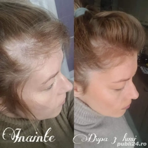 sampon nutriol anticadere si cresterea parului 