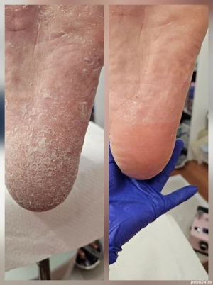 Pedichiură clasică Oradea  - imagine 3