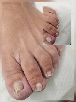 Pedichiură clasică Oradea  - imagine 5