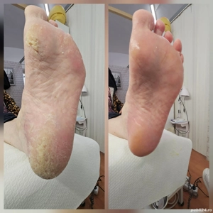 Pedichiură clasică Oradea  - imagine 2