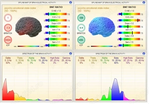 HRV Biofeedback si Biofeedback Biorezonanta S.C.I.O.
