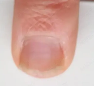 Podologie Bistrița Str.Dornei Nr 13