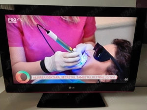 Televizor LCD HD LG de 81 cm cu tuner FreeviewHD incorporat - imagine 2