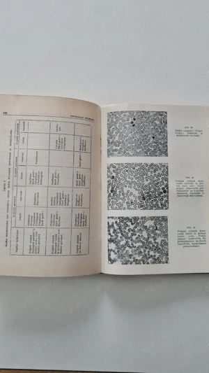 Patologie pulpara I. Constantin 1981 - imagine 5