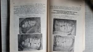 Practica stomatologica Parodontologie Ioan I. Gall 1977 - imagine 4