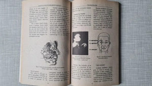 Odonto stomatologie medico legala Vasile Astarastoae 1995 - imagine 4