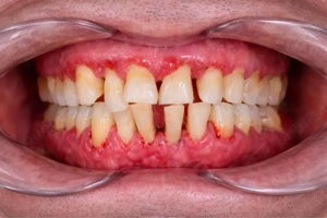 Consult stomatologic GRATUIT Facultatea de Medicină Dentară Timisoara 