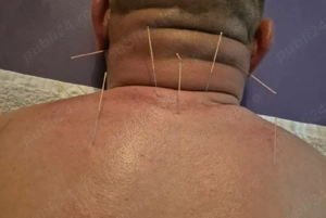 Masaj Si Acupunctura la Domiciliu 