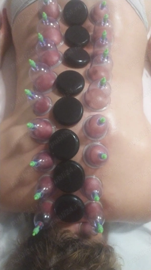 Masaj  si Acupunctura  - imagine 4