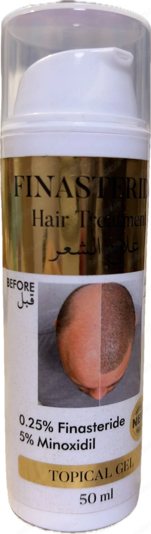 Topic Minoxidil 5% si Finastirida 0.25% - imagine 3