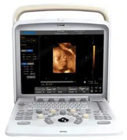 Ecograf color portabil Doppler Q5