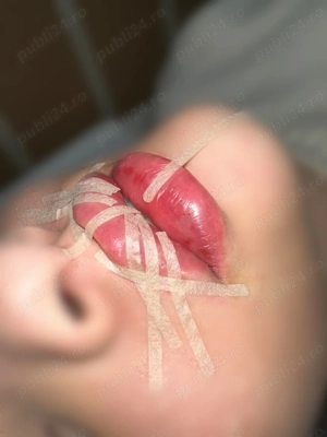 Ofertă acid hialuronic în buze     lucrez cu Revolax Deep  Pantelimon  . Vă aștept cu mesaje în pr