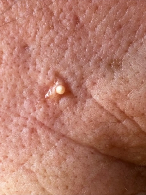 Saab 93 Cabrio TTiD 2011 - imagine 6