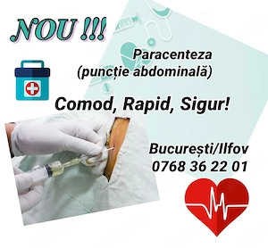 Paracenteza la domiciliu in București si Ilfov 