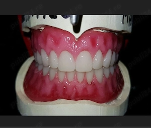 tehnician dentar caut joob , doresc seriozitate - imagine 4