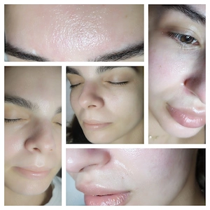 HydraFacial Premium 