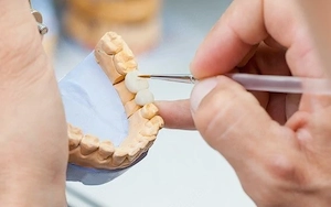 Angajam tehnician dentar ceramist cu experienta.