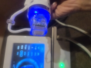 Radiofrecventa cu microneedling 
