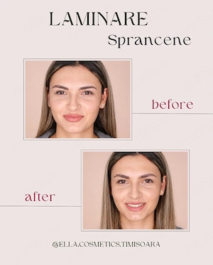 REDUCERI - Salon Nou În Timișoara   Tratamente Faciale, Laminare, Epilare (Zona Calea Șagului) - imagine 5