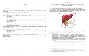 Îngrijirea pacientului cu Ciroză Hepatică - Lucrare diplomă  licență AMG