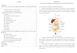 Îngrijirea pacientului cu Ulcer gastro-duodenal - Lucrare diplomă  licență AMG