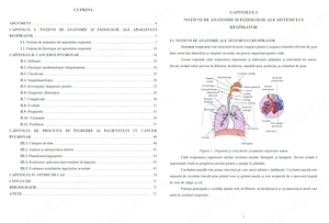 Îngrijirea pacientului cu Cancer Pulmonar - Lucrare diplomă  licență AMG