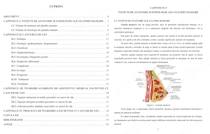 Îngrijirea pacientei cu Cancer de sân  mamar- Lucrare diplomă  licență AMG