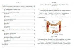 Îngrijirea pacientului cu Cancer de colon și rect - Lucrare diplomă  licență AMG